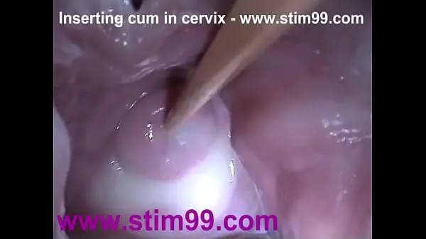 New Insertion Semen Cum in Cervix Wide Stretching Pussy Speculum cool Videos